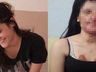 Yüzünü Yakan Kişiyle Evlenen Berfin Özek’in Babası Konuştu
