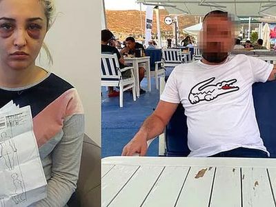 İzmir’de korkunç olay! Gamze Tümtürk’ün sevgilisi önce dövdü sonra uyumak istedi