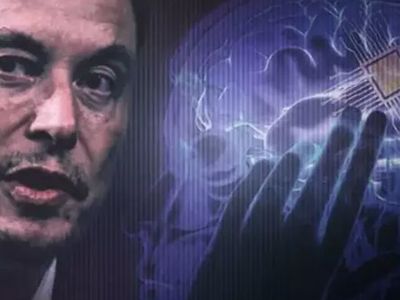 Dünyada ilk kez bir insanın beynine çip takmıştı! Son gelişmeleri açıkladı: Şok olacaksınız!