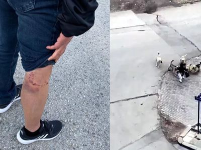 7 köpeğin arasında kaldı! Lise öğrencisinin hayatını güvenlik görevlisi kurtardı