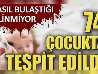 74 çocukta belirti gösteren gizemli hastalık nedir? Gizemli hastalık belirtileri nelerdir? Gizemli hastalık panik yaratmaya devam ediyor!