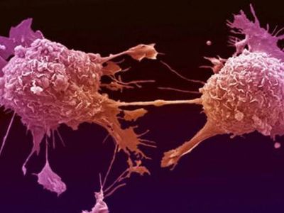 ABD'de Yeni Salgın Patlak Verdi, Salmonella Yayılıyor!