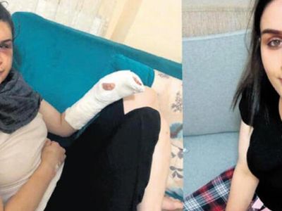 Boşanmak İsteyen Eşine Ailece İşkence Etmişlerdi! Cezaları Belli Oldu