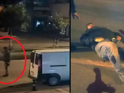 Akılalmaz Kaza! Otomobiliyle Çarptığı Kişinin Bacağını Kopardı
