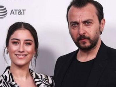 Ali Atay saç mı ektirdi? Ali Atay'dan radikal karar!
