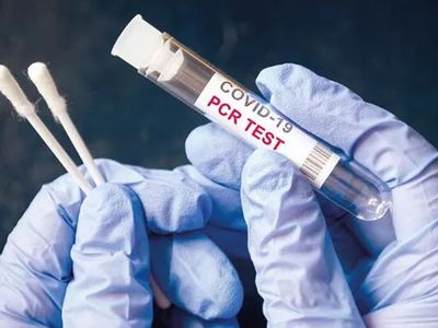 Almanya’da PCR Testleri Ücretli Oldu
