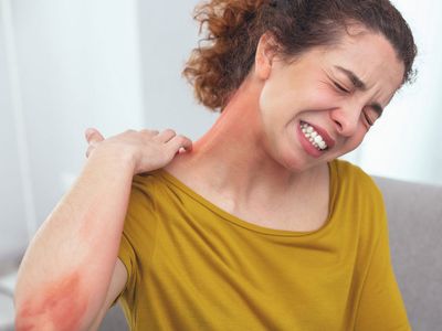 Anafilaksi Nedir, Belirtileri Nelerdir?