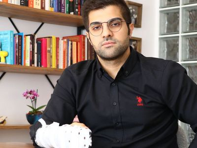 Ankara'da Elinden Bıçaklanan Doktor Ertan İskender: Sağlık Çalışanları Risk Altında Çalışıyor