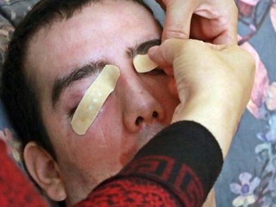 Antalya’da Yaşayan Genç Adamın Başına Öyle Bir Şey Geldi ki 8 Yıldır Gözlerini Kapatamıyor