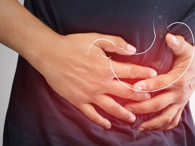 Apandisit nedir, belirtileri nelerdir, neden olur, nasıl anlaşılır? 