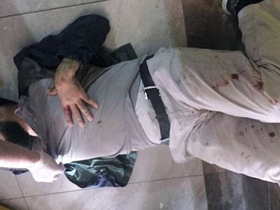 Asansöre Binen Baba Ve Oğlu, 11'inci Kattan Yere Çakıldı