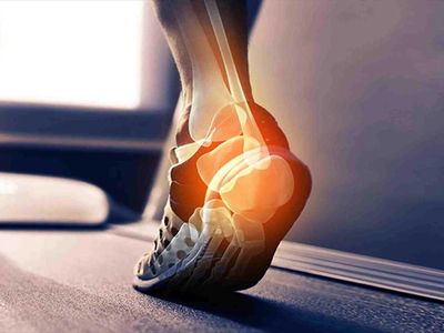 Aşil Tendonu kopması nedir, neresi ve vücutta nerede? Aşil tendonu kopması tedavi süreci ne kadar sürer?