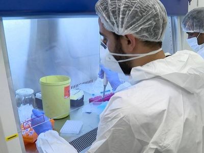 Aynı anda 3 hastalığı tespit edebiliyor: Yerli tanı kiti hastanelerde kullanılacak