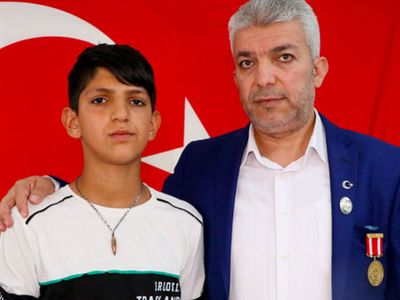 Babasını Vuran Kurşunu Boynunda Taşıyor
