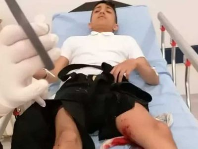 Başıboş köpek saldırısı devam ediyor: Okula giderken köpeklerin saldırısına uğradı
