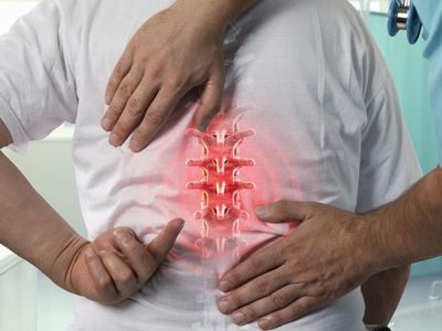 Bel ağrısına ne iyi gelir? Bel ağrısına şifa olan 5 bitkisel çözüm