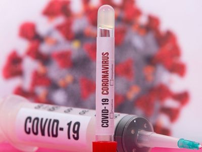 Bilim Kurulu Üyesi Omicron Varyantının Yeni Belirtisini Açıkladı!