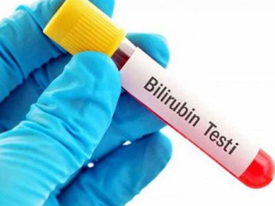 Bilirubin Nedir, Bilirubin Yüksekliği Ve Düşüklüğünün Sebepleri Nelerdir?