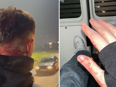 Bosnalı taraftarlar Türk taraftarlara saldırdı