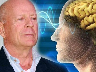 Bruce Willis'in hastalığı afazi nedir? Afazi hastalığı nedir, belirtileri nelerdir?