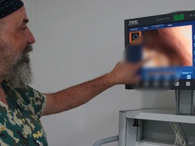 Burun tıkanıklığı ve hapşırık şikayetiyle doktora gitti: Öğrendiği gerçek karşısında neye uğradığını şaşırdı