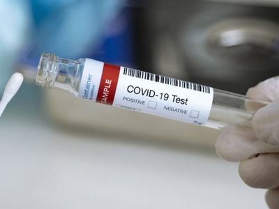 Çinli Araştırmacılardan Yeni Buluş: Koronavirüs Testi 4 Dakikada Sonuçlanıyor!