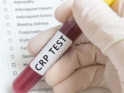 CRP yüksekliği nedir?