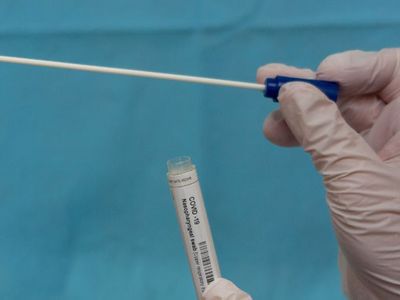 Çubuksuz ve Kansız Kovid-19 Testi Geliştirildi!