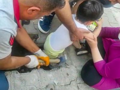 Diyarbakır’da Bacağı Sıkışan Çocuğa İtfaiye Ekipleri Yetişti