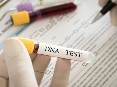 DNA testi için gelmişlerdi: 186 milyon liralık miras aldılar