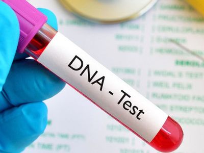 Dna Testi Nasıl Yapılır?