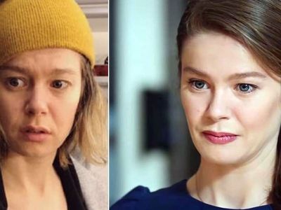 Doğal Olduğunu Savunan Burcu Biricik'in Eski Hali Ortaya Çıktı!