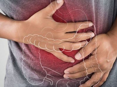 En hızlı bağırsak temizleme yöntemi nedir? Bu kür yardımıyla bağırsaklarınızdaki bakterilerden kurtulacaksınız!