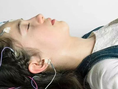 Epilepsi hastalığı nedir? Epilepsi hastaları hangi spordan uzak durmalıdır?