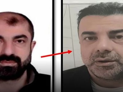 Estetikle Yüzünü Değiştirip Kaçan Firari Zanlı Yakalandı
