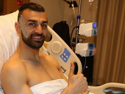 Fenerbahçe'de Giresunspor Maçında Sakatlanan Serdar Dursun İçin Özel Maske Yapılacak!