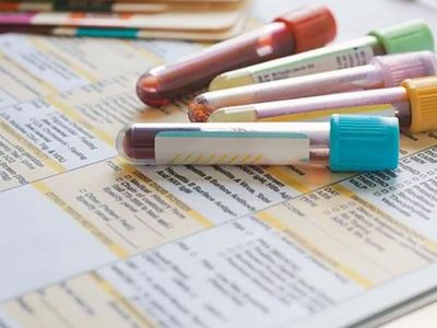 Ferritin nedir, ne demek? Ferritin testi nasıl yapılır? Ferritin normal değerleri