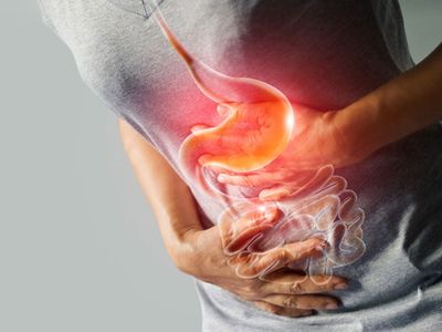 Gastrit nedir, belirtileri nelerdir, neden olur, nasıl tedavi edilir? Gastrite iyi gelen besinler 