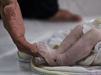 Gazze’de Soğuk Bir Can Daha Aldı: 3 Aylık Tim Çadırda Donarak Öldü