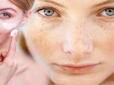 Güneş lekelerini anında çıkaran kaymak gibi lekesiz bir cilt için doğal yağ önerileri