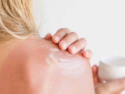 Güneş yanığına ne iyi gelir? Yüzdeki güneş yanığı nasıl geçer? Zararlı güneş ışınlarından korunmanın yolları sizin için araştırdık