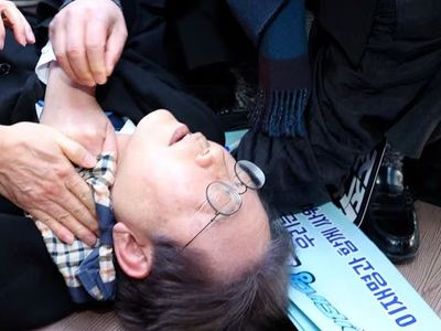 Güney Kore'de skandal olay: Parti lideri boynundan bıçaklandı