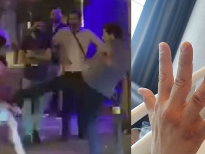 Güvenlik Görevlisinin Parmağını Isırıp Kopardı: 4,5 yıl Hapsi İstendi