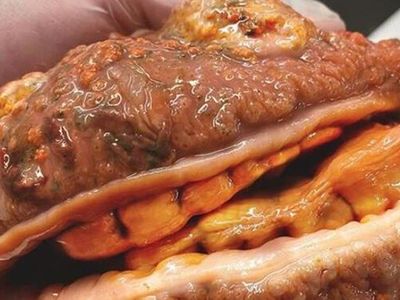 Hamburger Sandılar Balık Çıktı! Sosyal Medya Bu Görüntüleri Konuşuyor