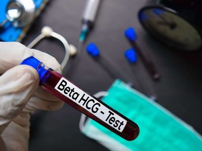 Hamilelik döneminde Beta HCG değerleri kaç olmalıdır? Beta HCG gebelik hesaplama tablosu 2022