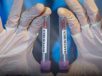 Hantavirüs Şüphesiyle Getirilen Türk Vatandaşlarının Testleri Negatif Çıktı