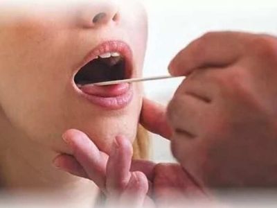 Harita dil hastalığı nedir, nasıl tedavi edilir? Harita dil hastalığında tedavi yöntemleri