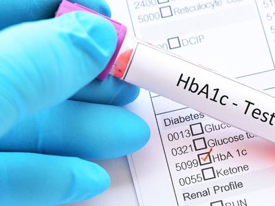 HbA1c nedir, normal değeri kaç olmalı, tedavisi nasıl yapılır?  Şeker hastalarının kabusu HbA1c yüksekliği hakkında bilmeniz gerekenler 
