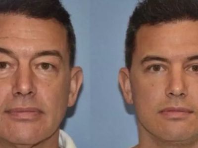 Herkes bu estetik cerrahını konuşuyor: Gençleştirme ameliyatı sonrası artık oğlundan daha genç görünüyor!