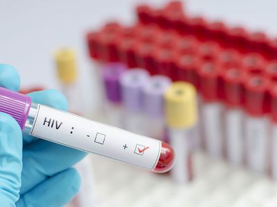 HIV nedir, belirtileri nelerdir, nasıl bulaşır, ölümcül müdür? HIV'in tespit edilen 3 bulaşma yolu